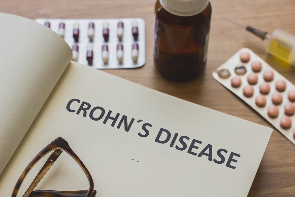 Maintenance of remission in Crohn’s disease NICE Guidelines 2019