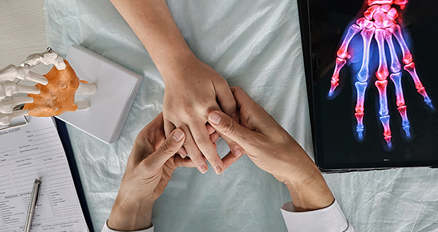 semaglutide and psoriatic arthritis Role of GLP-1 Drugs in Psoriasis PsA Is Debated Psoriatic arthritis in general practice