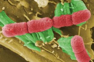 Enterohaemorrhagic E. coli (EHEC) bacteria images by Helmholtz-Zentrum fur Infektionsforschung (HZI), Germany - Jun 2011