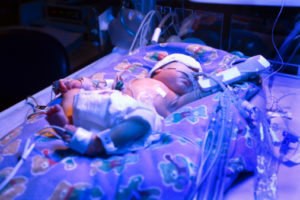 Premature-baby-web-image-90662653