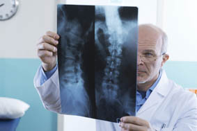 Spine-xray-470547095