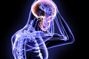 X-ray-concussion-crop-489192483