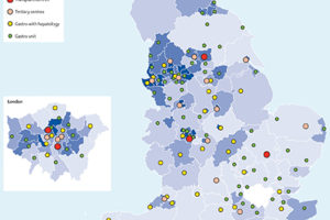 Image-for-Clinical-Review-page-Liver_Map_Fig
