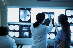 radiography-ThinkstockPhotos-78490106