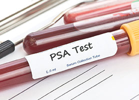 Prostate-cancer1-ThinkstockPhotos-471587798