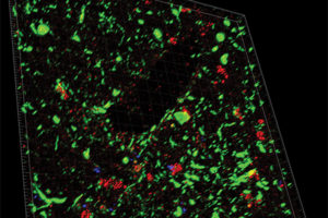 Staining-of-blood-vessels-in-CTE-IIweb