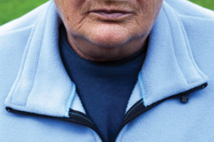 Senior woman with Chronic obstructive pulmonary disease with supplemental oxygen