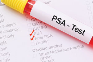 PSA testing
