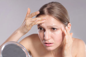 Discourage picking, most common in young females — it scars. 
And confiscate their magnifying mirror. Pic: Getty Images