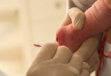 newborn screening