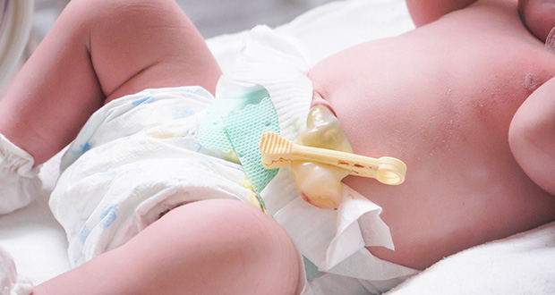 Deferred umbilical cord clamping reduces premature baby death risk – study
