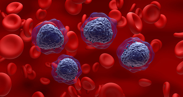 Treatment advances fuel renewed hope in overcoming multiple myeloma