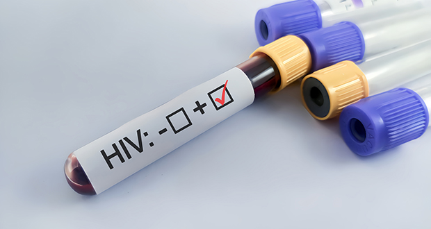 Four-in-ten First-Time HIV Diagnoses Found Late in Ireland