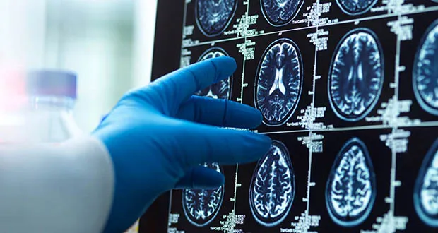 Europe on ‘crest of a wave’ for EU-wide neurological strategy